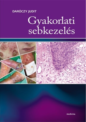 Gyakorlati sebkezelés 2358